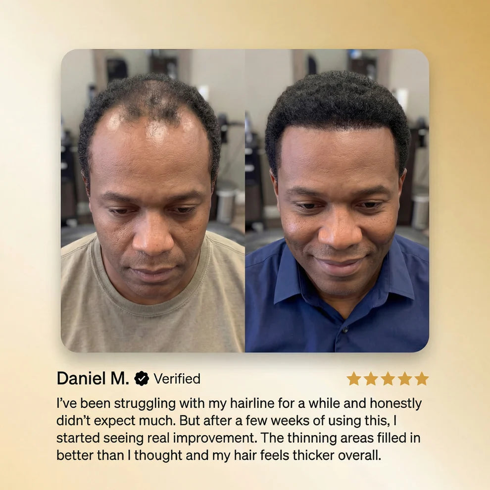 Aureva Hair™ Growth Serum